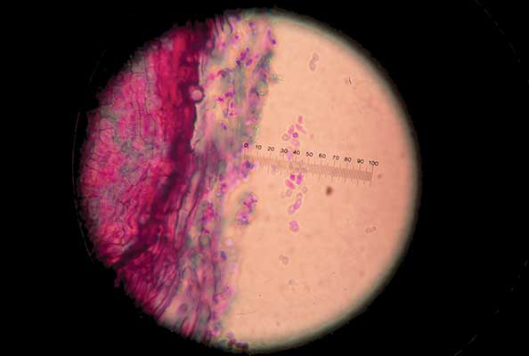 Imagen principal del artículo Micotoxinas: venenos naturales