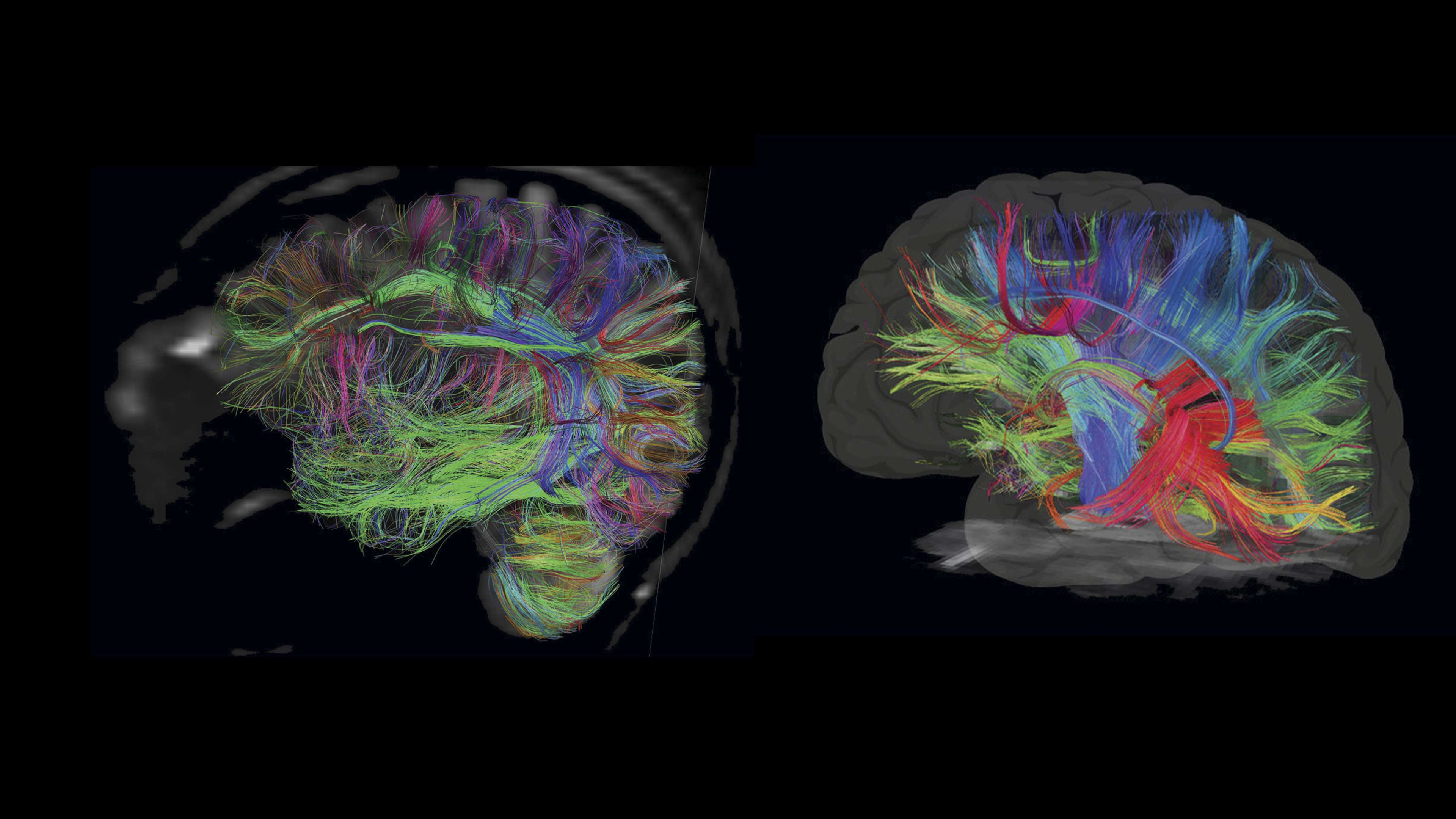 AnticuerposLa belleza está… en tu cerebro