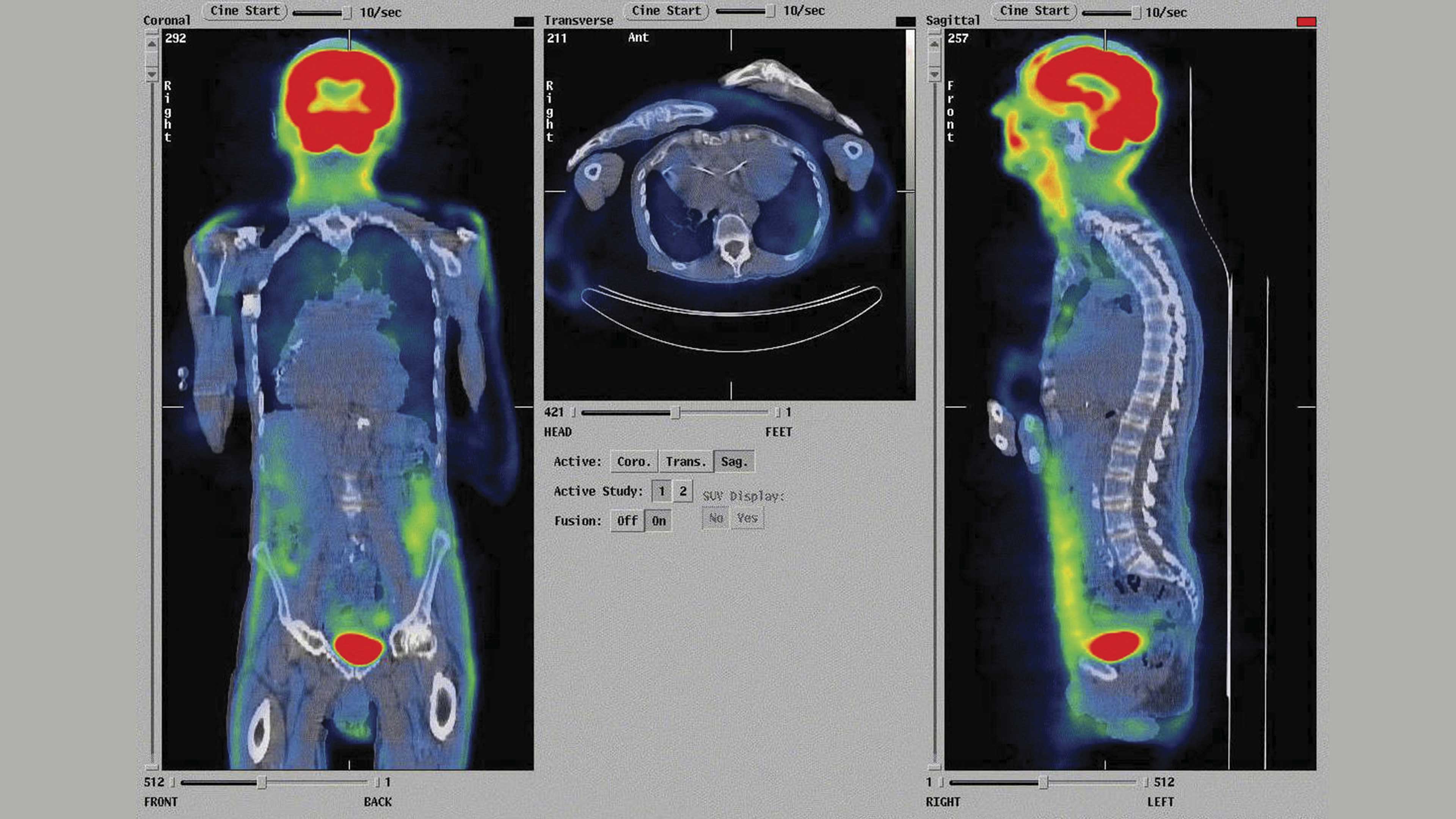 Para verte mejor: el cuerpo por dentro