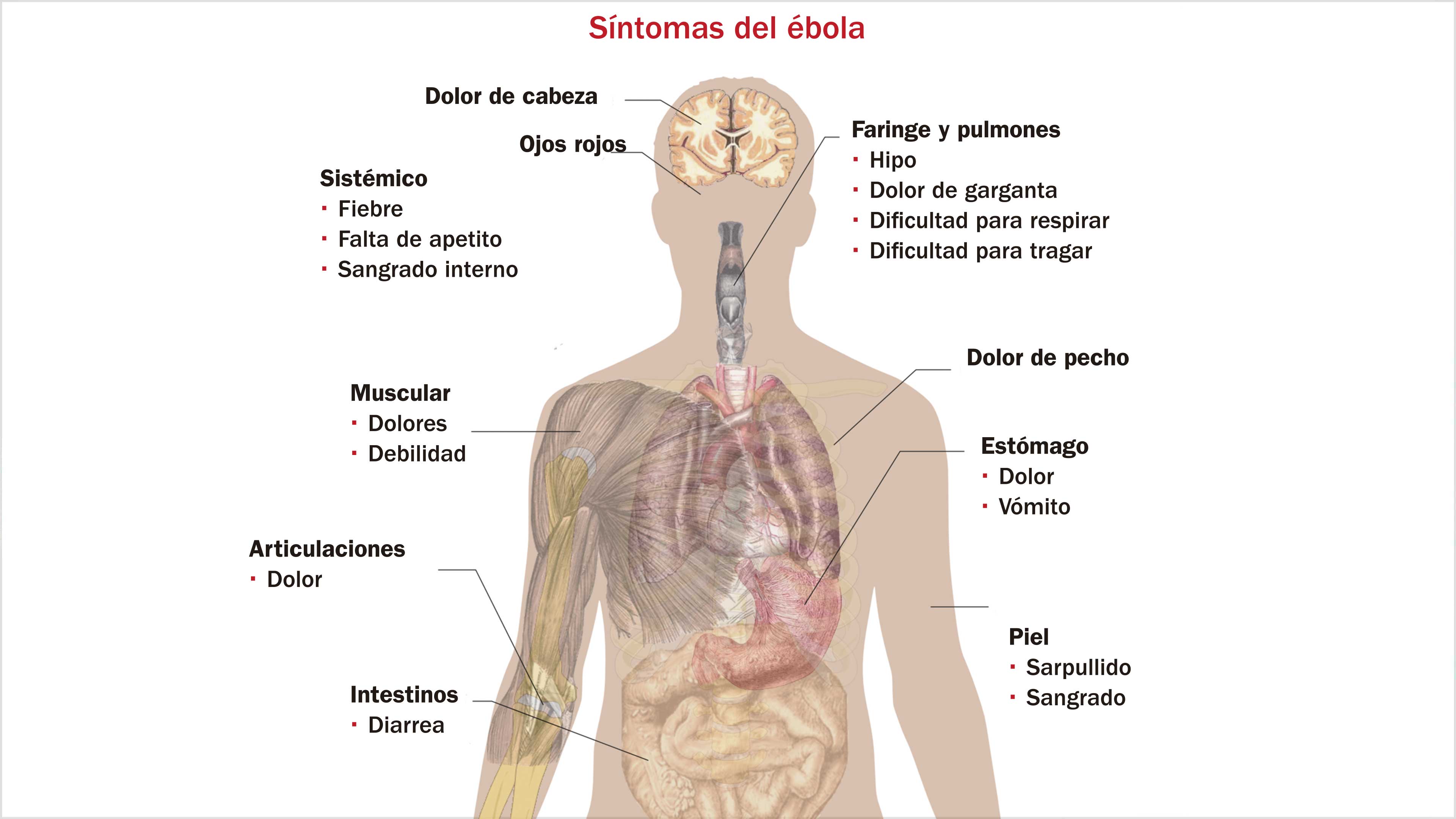 Ébola: retrato de una epidemia