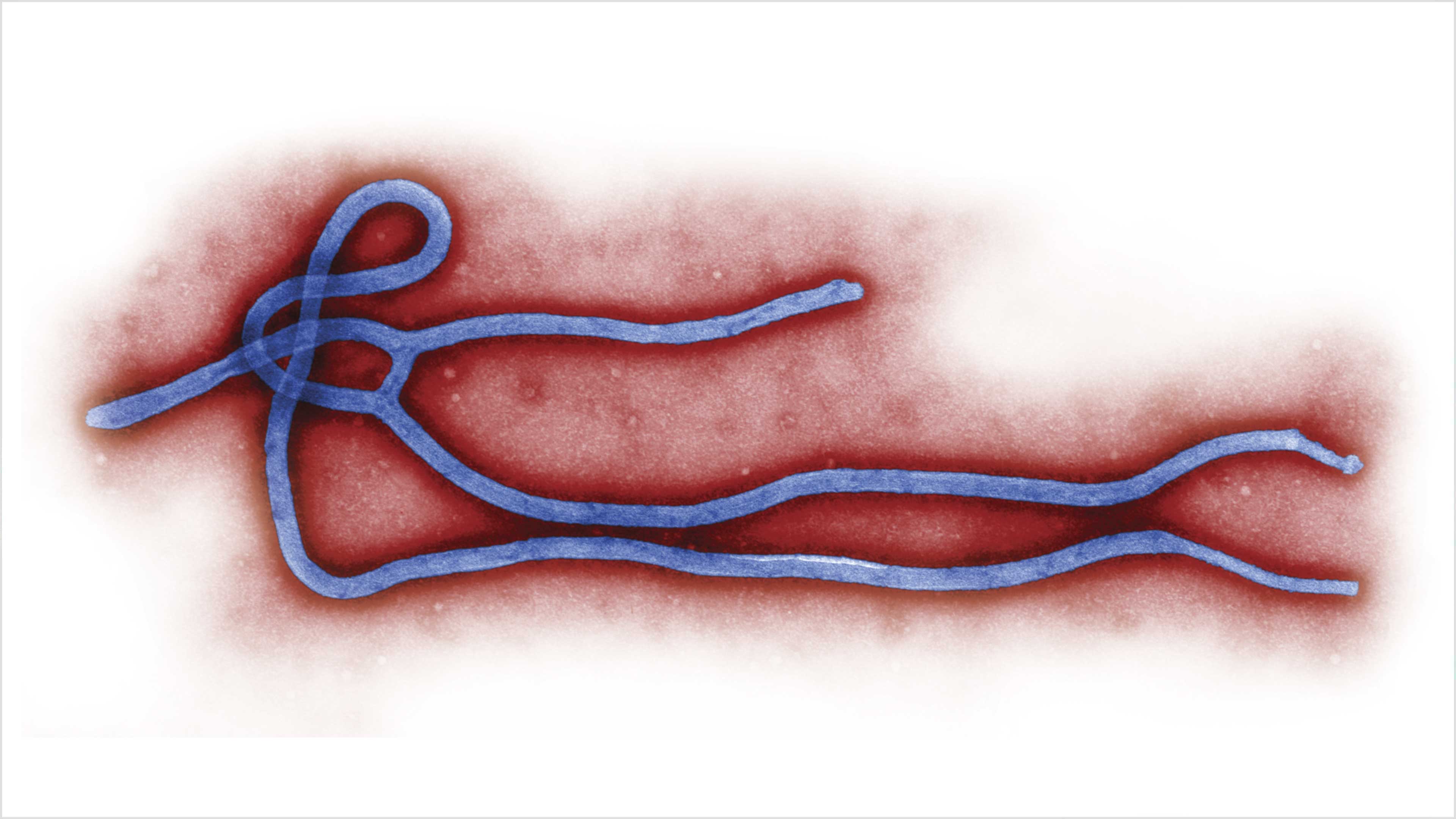 Imagen de Ébola: retrato de una epidemia