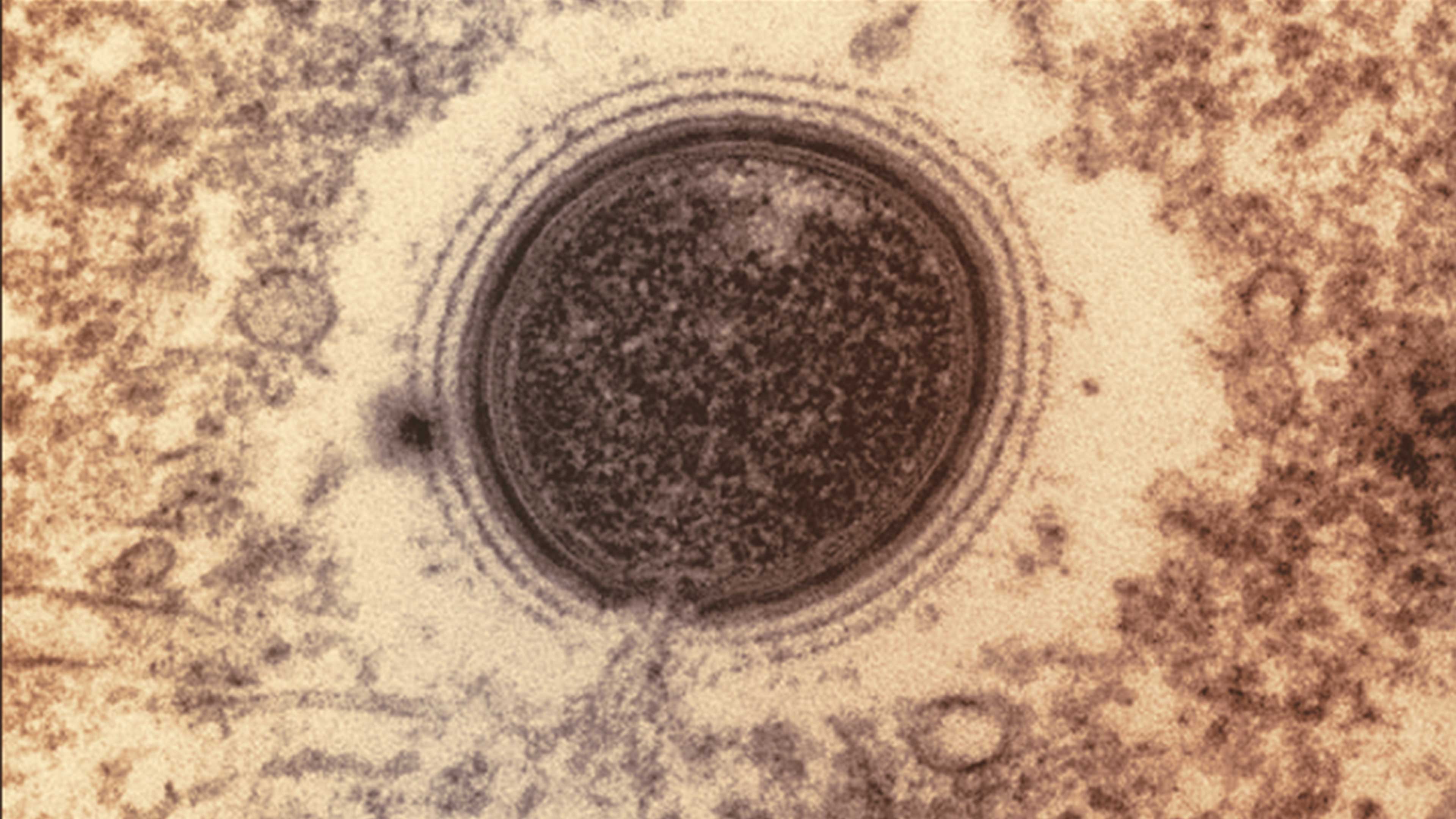 Virus de miles de años conservan la capacidad de infectar