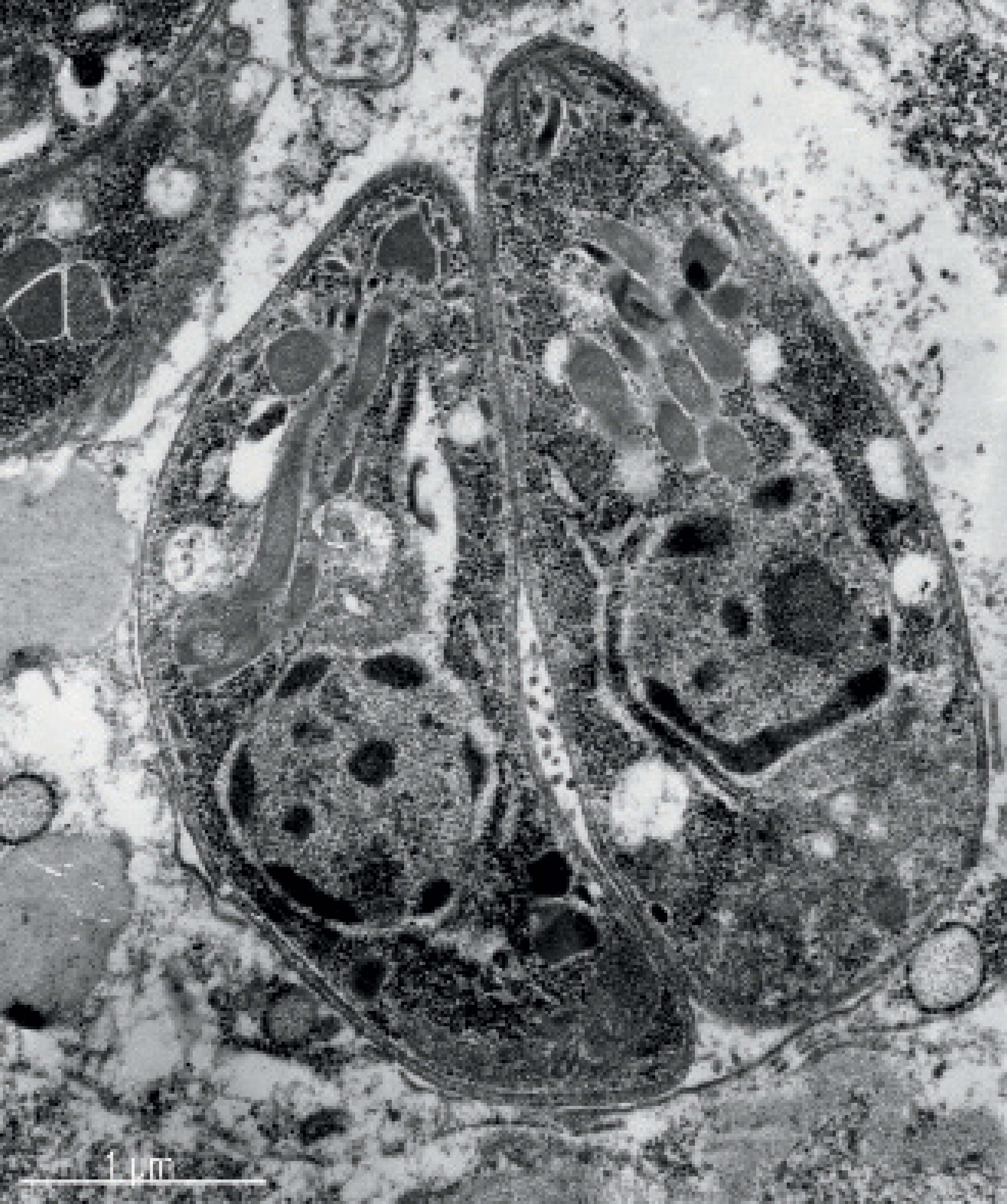 Toxoplasma. Un parásito manipulador