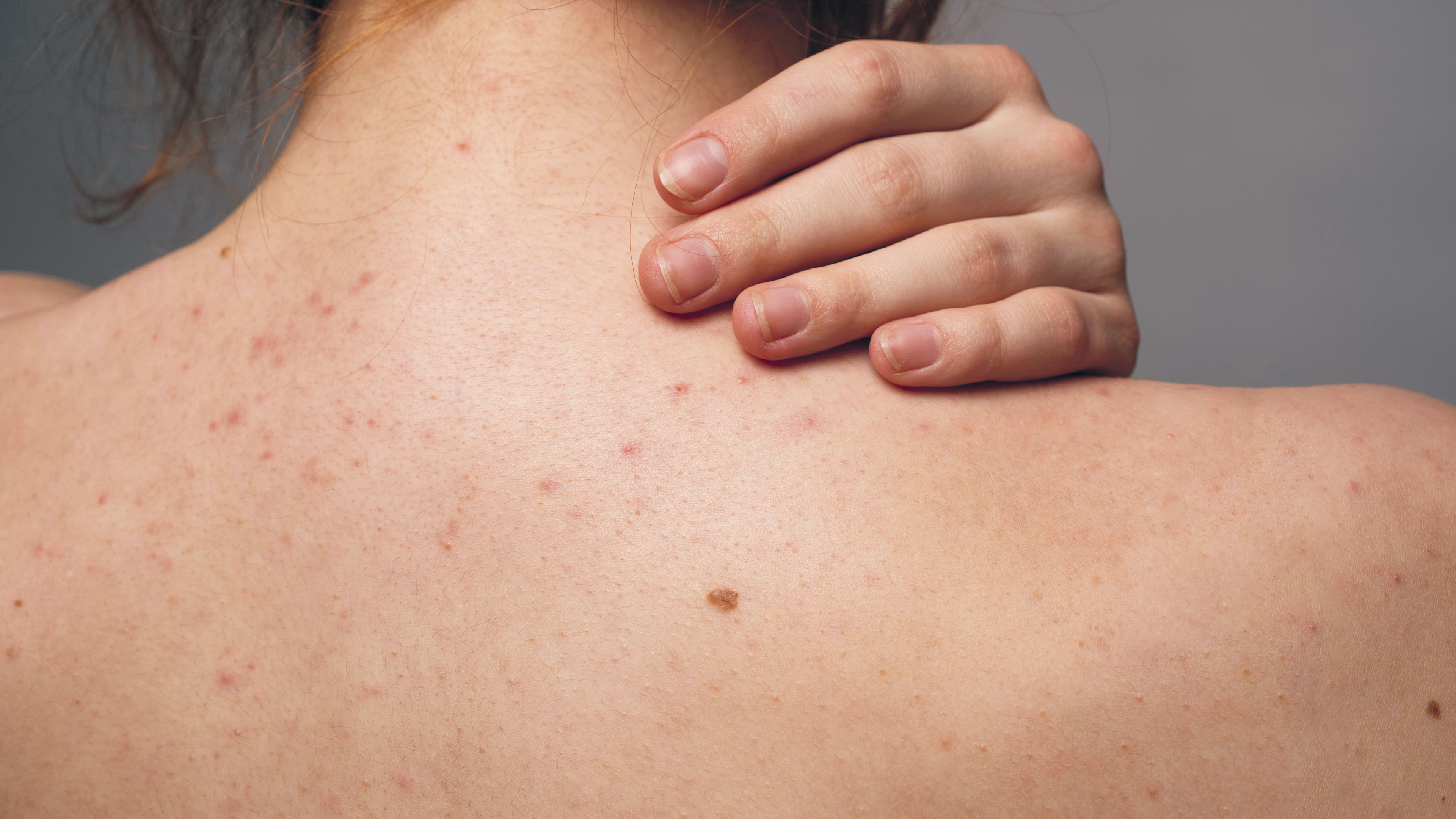 Caras vemos, microbiotas no sabemos